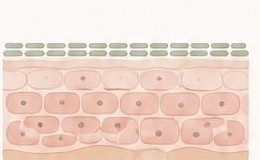 Reinforced skin structure