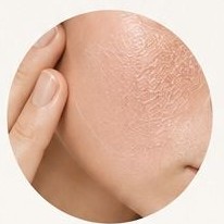 Tight, dry-looking skin