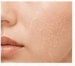 Dry, patchy skin