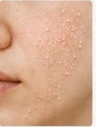 Exfoliating scrub on skin